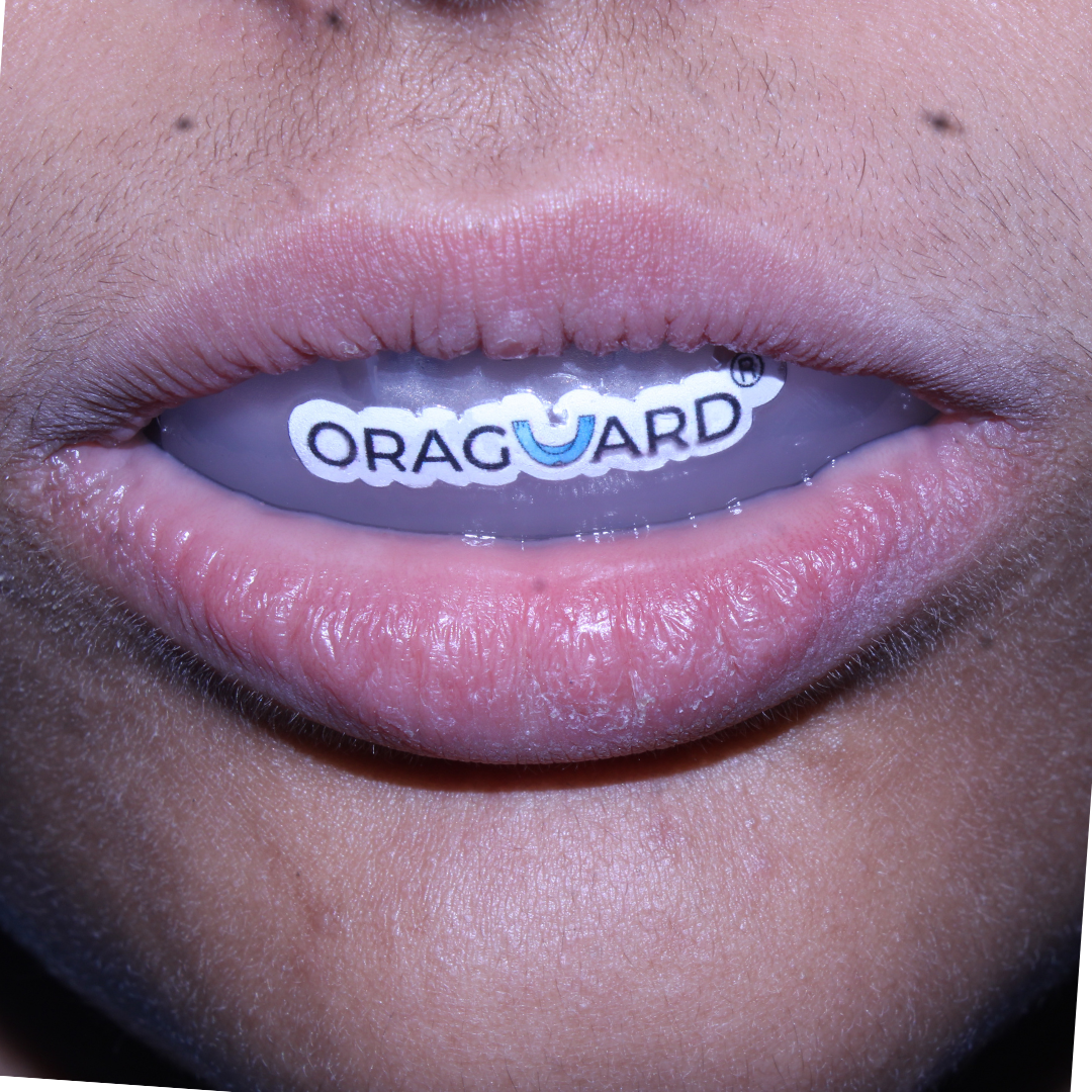 ORAGUARD® BRACESAFE - Image 2